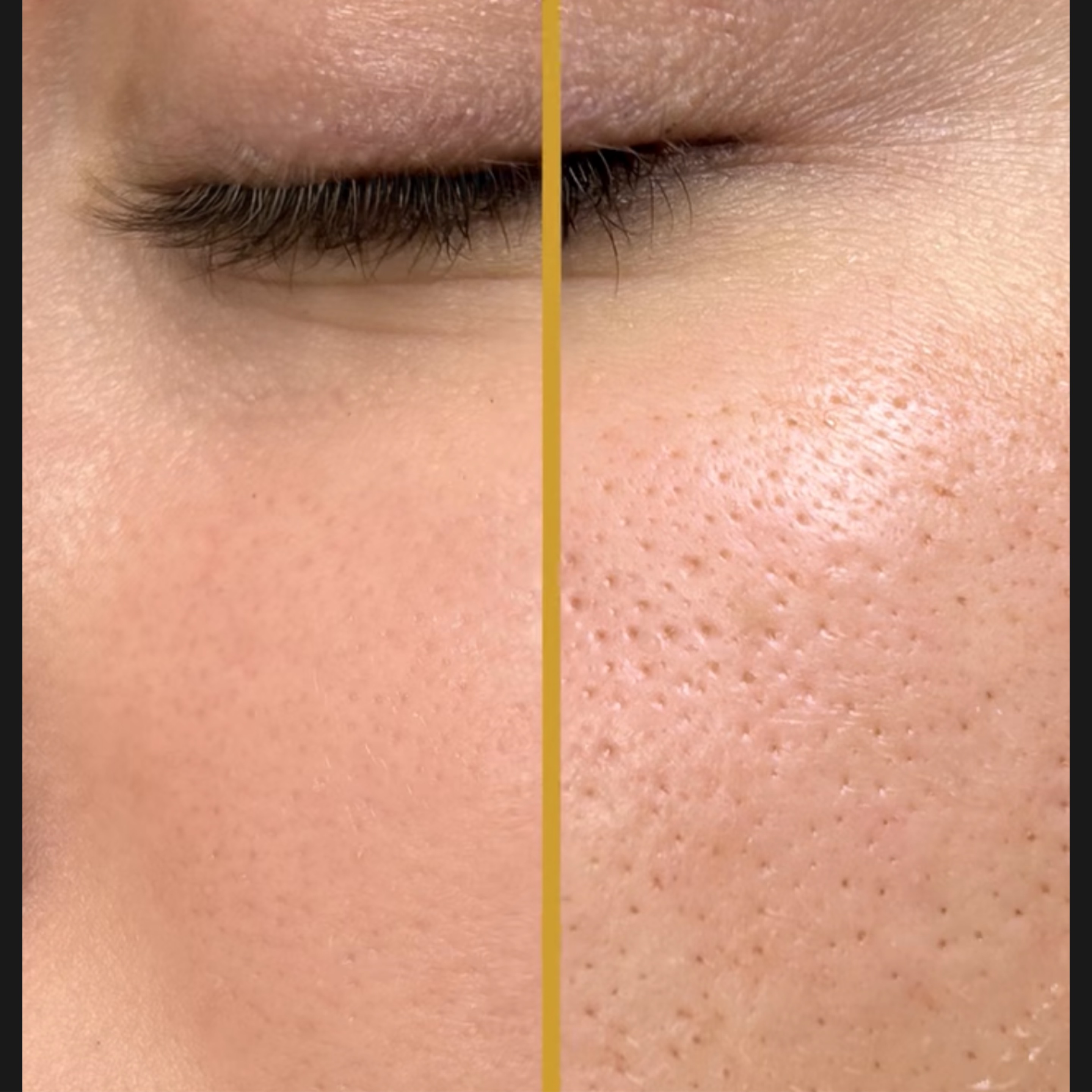 Service: COSMETOLOGY – Facial (IS Clinical)