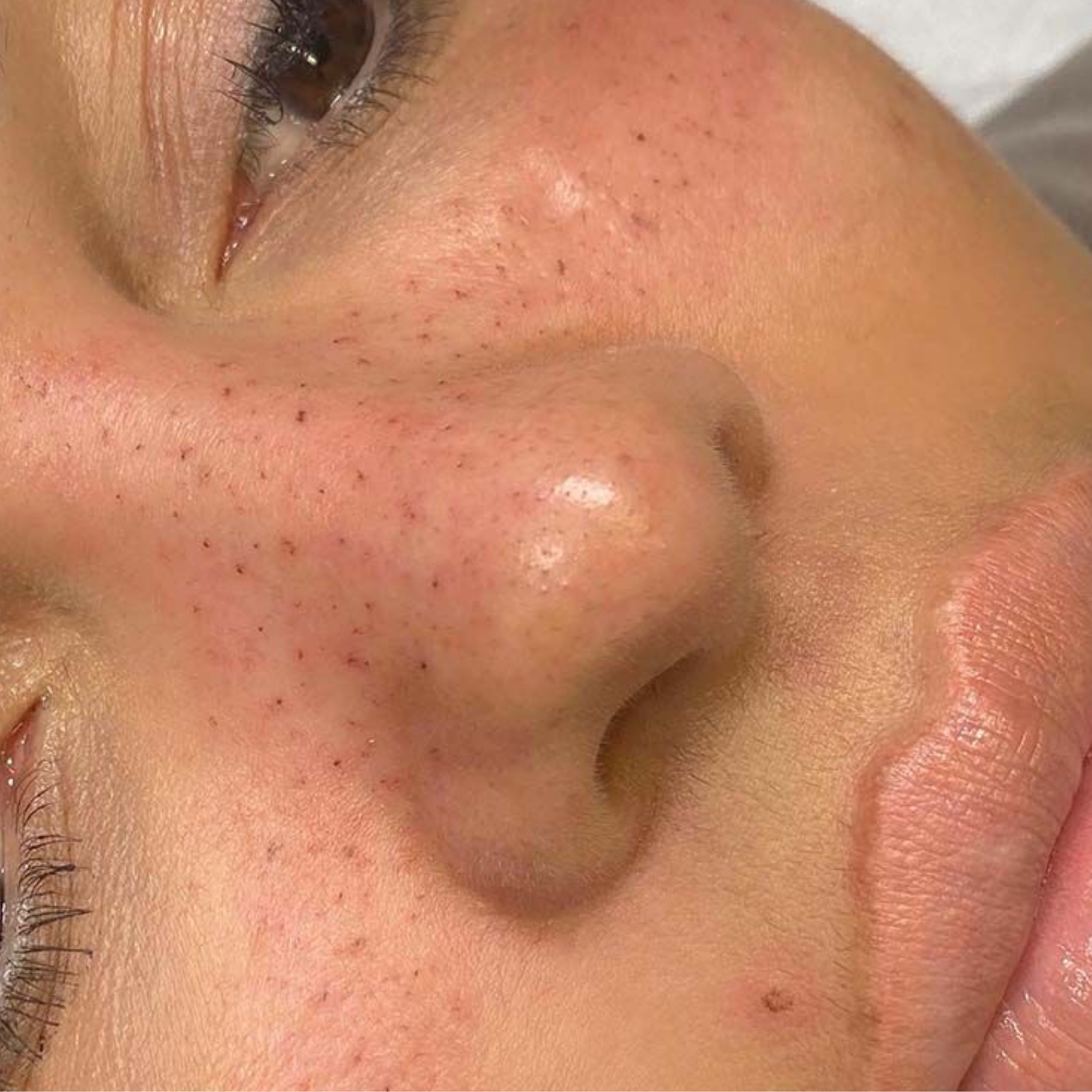 Service: PMU – Freckles