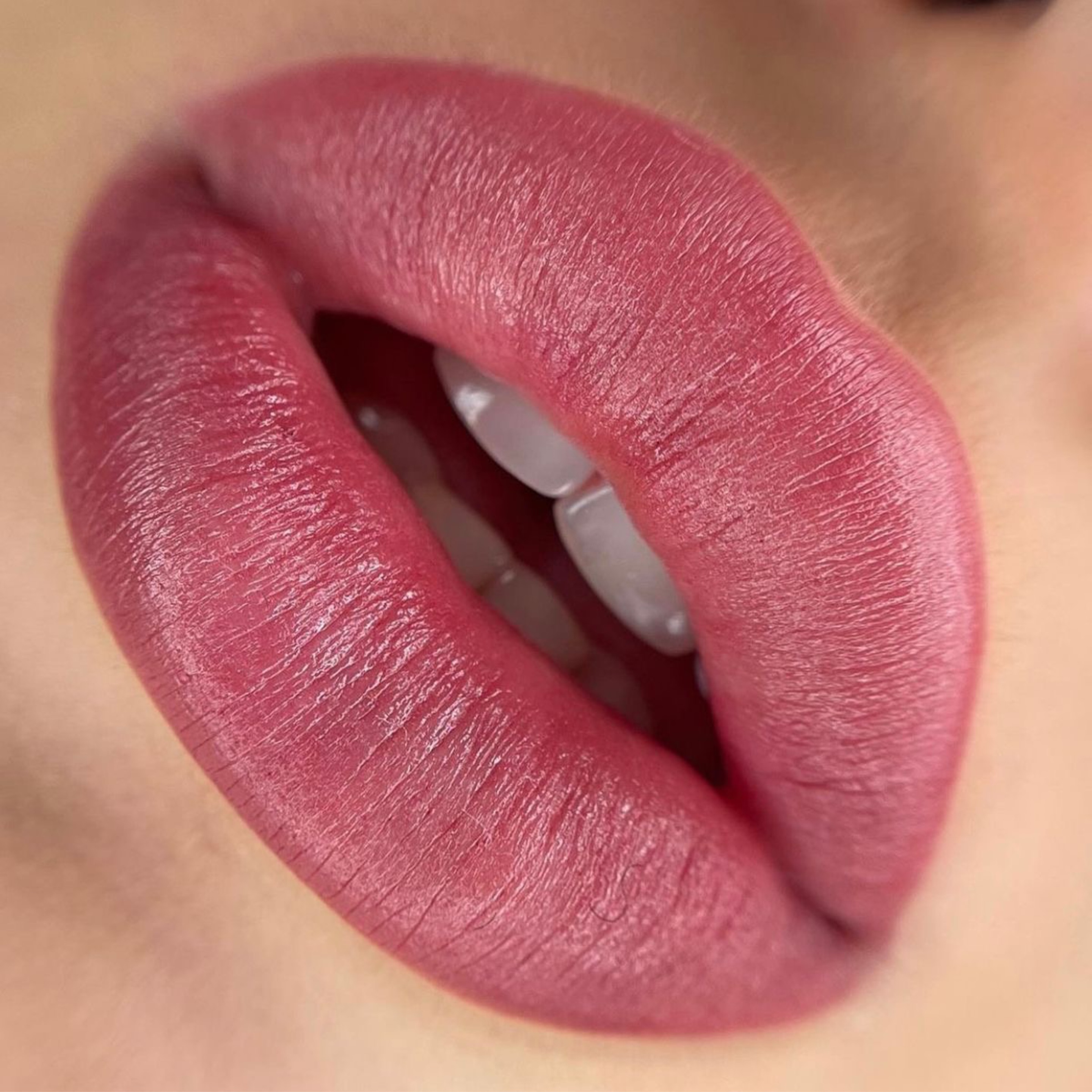 Service: PMU – Lips
